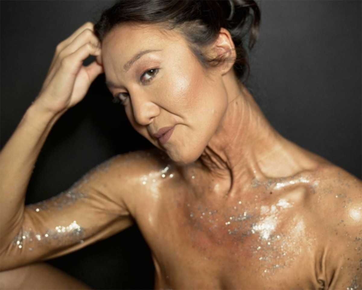 Atteinte d'une maladie génétique rare, cette mannequin de 26 ans a la peau élastique